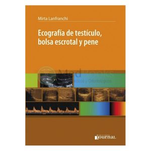 Ecografía de testículo, bolsa escrotal y pene (eBook)