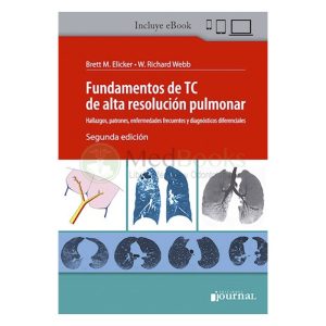 Fundamentos de TC de Alta Resolución Pulmonar (eBook)