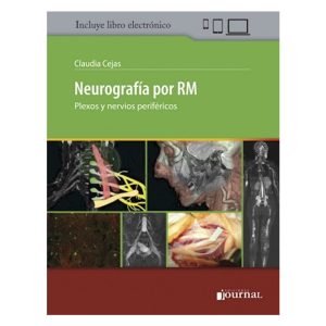 Neurografía por RM (eBook)