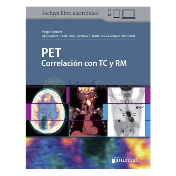 PET Correlación con TC y RM (eBook)