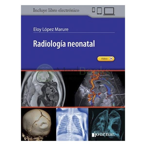 Radiología neonatal (eBook)