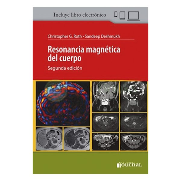 Resonancia Magnética del Cuerpo Ed.2 (eBook)
