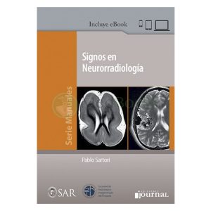 Signos en Neurorradiología (eBook)