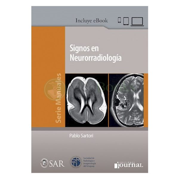 Signos en Neurorradiología (eBook)