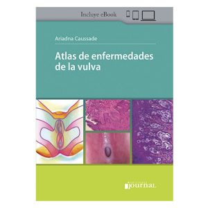 Atlas de Enfermedades de la Vulva
