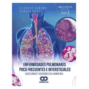 Enfermedades Pulmonares Poco Frecuentes e Intersticiales