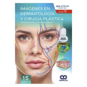 Imágenes en Dermatología y Cirugía Plástica