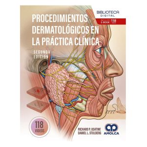 Procedimientos Dermatológicos en la Práctica Clínica