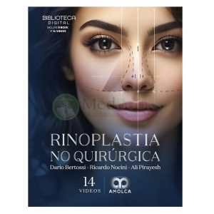 Rinoplastia No Quirúrgica