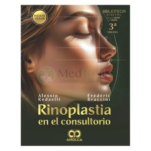 Rinoplastia en el Consultorio