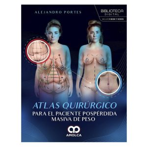 Atlas Quirúrgico para el Paciente Pospérdida Masiva de Peso