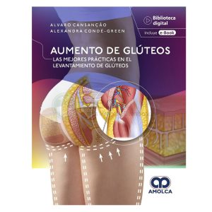 Aumento de Glúteos. Las Mejores Prácticas en el Levantamiento de Glúteos