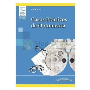 Casos prácticos de optometría