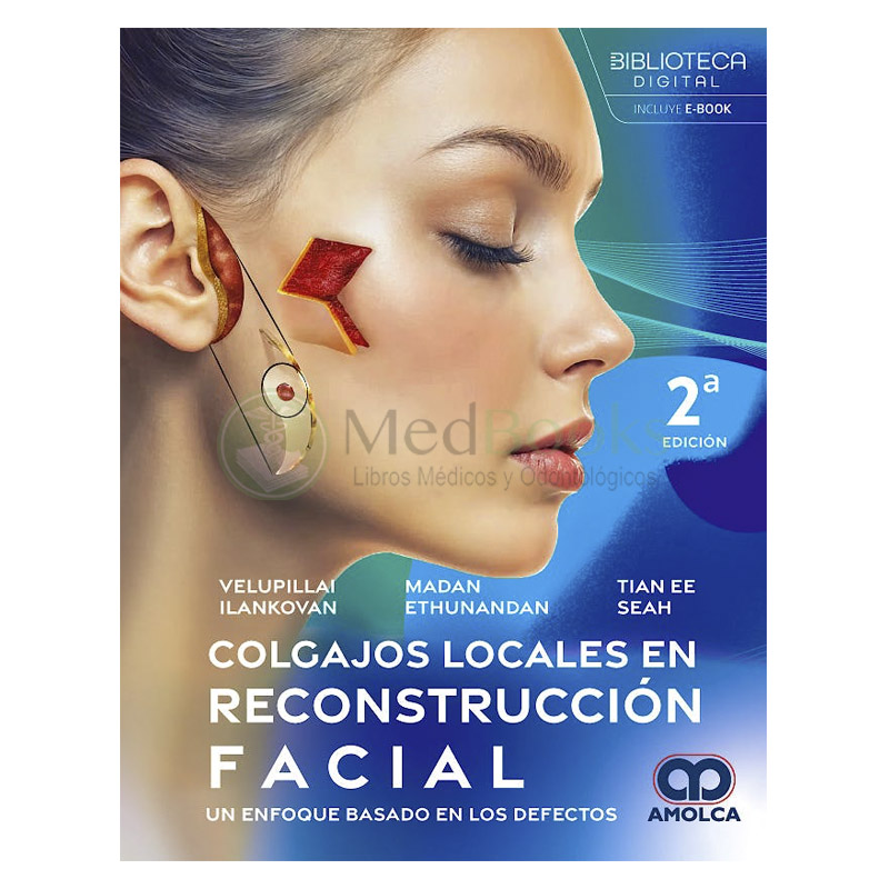 Colgajos Locales en Reconstrucción Facial. Un Enfoque Basado en los Defectos