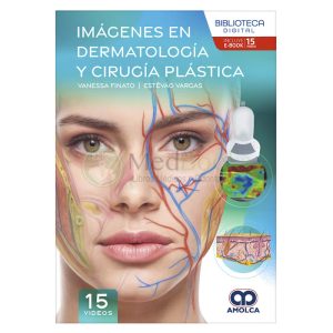 Imágenes en Dermatología y Cirugía Plástica