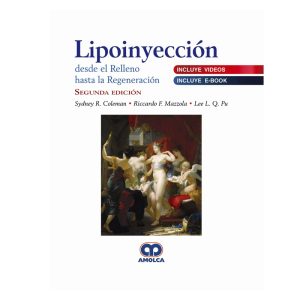 Lipoinyección desde el Relleno hasta la Regeneración (Incluye Videos)