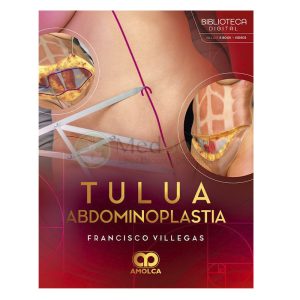 TULUA Abdominoplastia