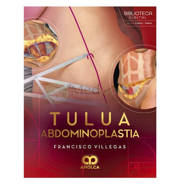 TULUA Abdominoplastia