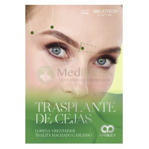 Trasplante de Cejas
