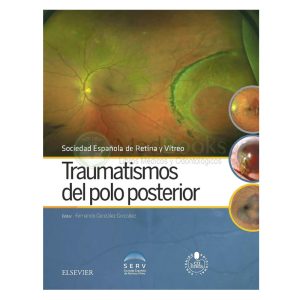 Traumatismos del polo posterior