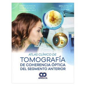 Atlas Clínico de Tomografía de Coherencia Óptica del Segmento Anterior