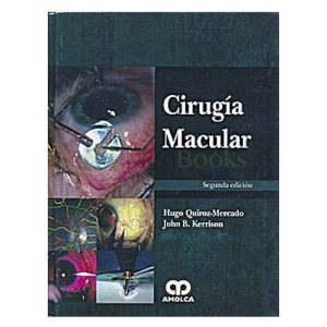 Cirugia Macular