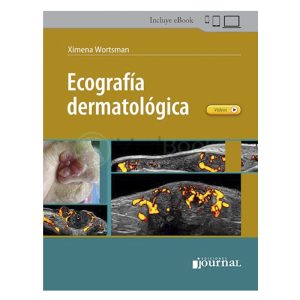 Ecografía Dermatológica