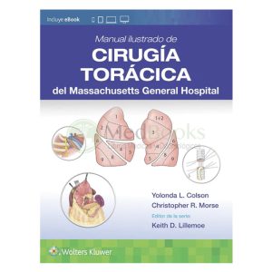 Manual ilustrado de Cirugía torácica del Massachusetts General Hospitalv