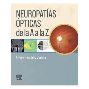 Neuropatías ópticas de la A a la Z
