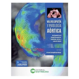 Valvulopatía y patología aórtica