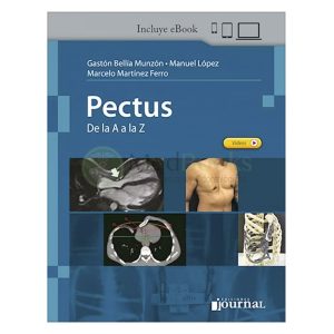 Pectus. De la A a la Z