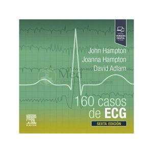 160 casos de ECG