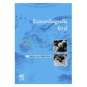 Ecocardiografía fetal