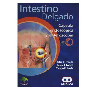 Intestino Delgado. Capsula Endoscópica y Enteroscopia. SOBED