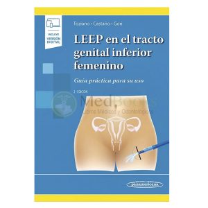 LEEP en el tracto genital inferior femenino