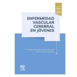 Enfermedad vascular cerebral en jóvenes