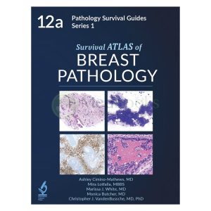 Survival ATLAS to Breast Pathology