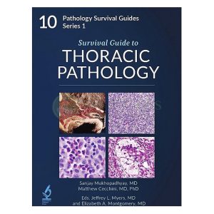 Survival Guide to Thoracic Pathology (Pathology Survival Guides Series 1, Vol. 10)