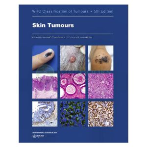 WHO Classification of Tumours: Skin Tumours (WHO Classification of Tumours, Vol. 12)