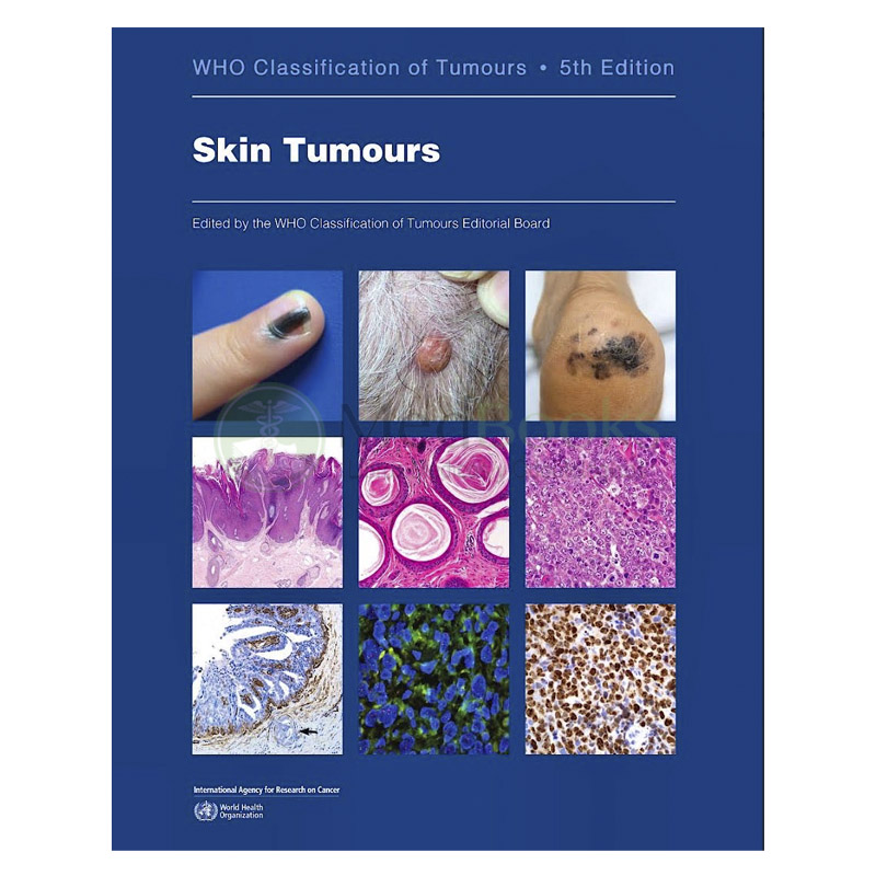 WHO Classification of Tumours: Skin Tumours (WHO Classification of Tumours, Vol. 12)