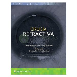 Cirugía refractiva